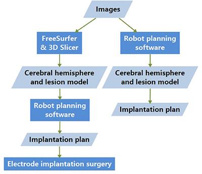 FreeSurfer and 3D Slicer-Assisted SEEG Implantation for Drug-Resistant Epilepsy